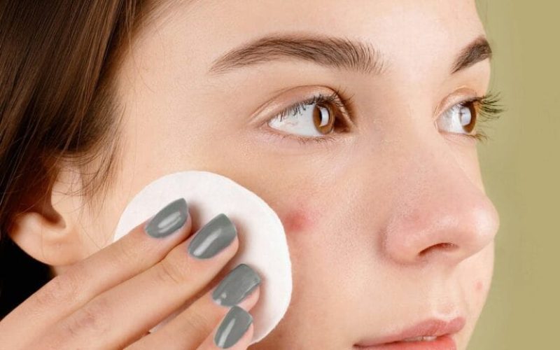 Vette huid verzorging Vette huid verzorging